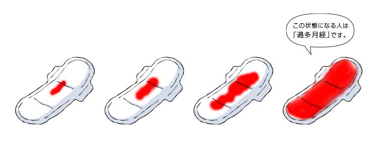 経血量